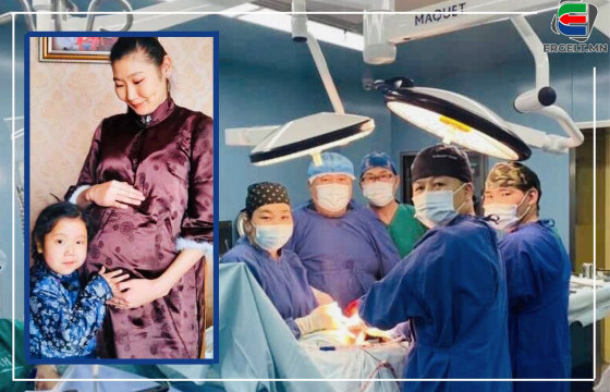 Д.НАСАНЖАРГАЛ: Долоон жил өвдсөн охинд минь Монголын мэс заслын шилдэг эмч нар элэг шилжүүлэн суулгалаа